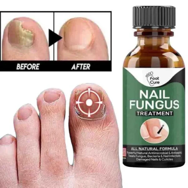 Fast Nail Fungal