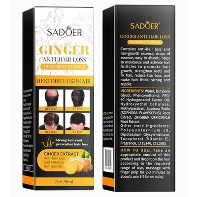 Sadoer Ginger Anti-hair Loss Treatment