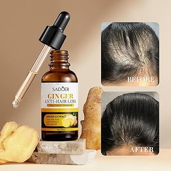 Sadoer Ginger Anti-hair Loss Treatment